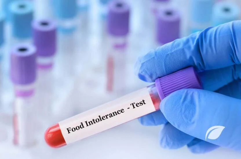 Histamin İntoleransı Diyeti