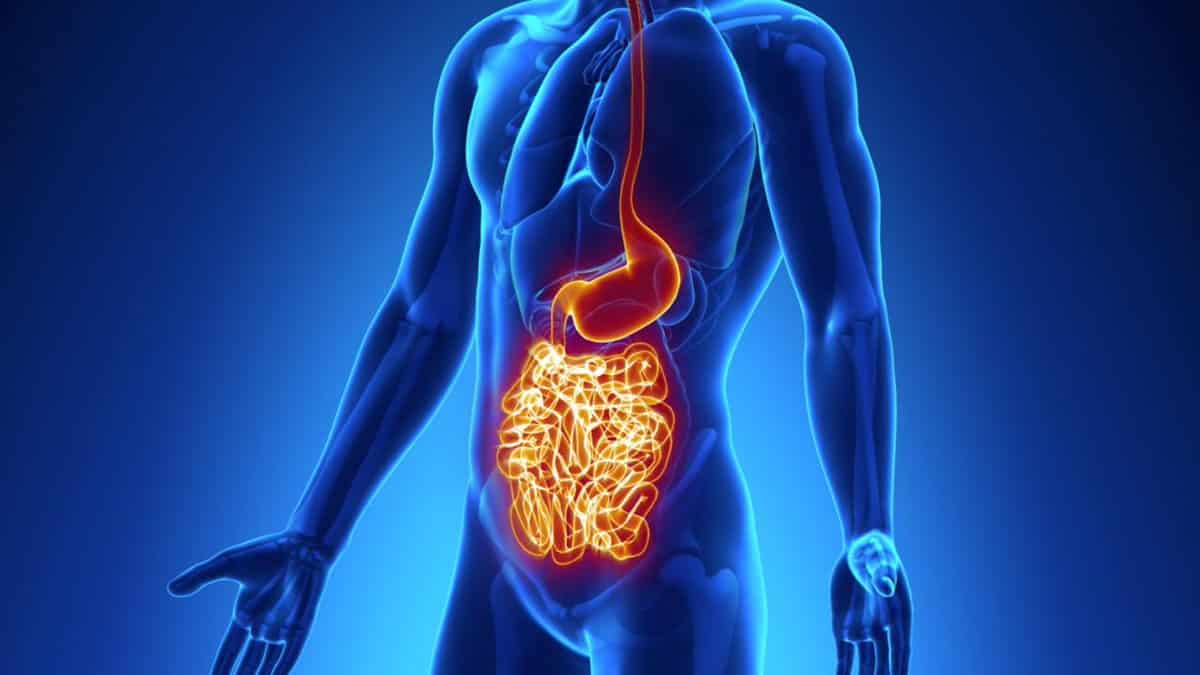 Crohn Hastalığı Nedenleri
