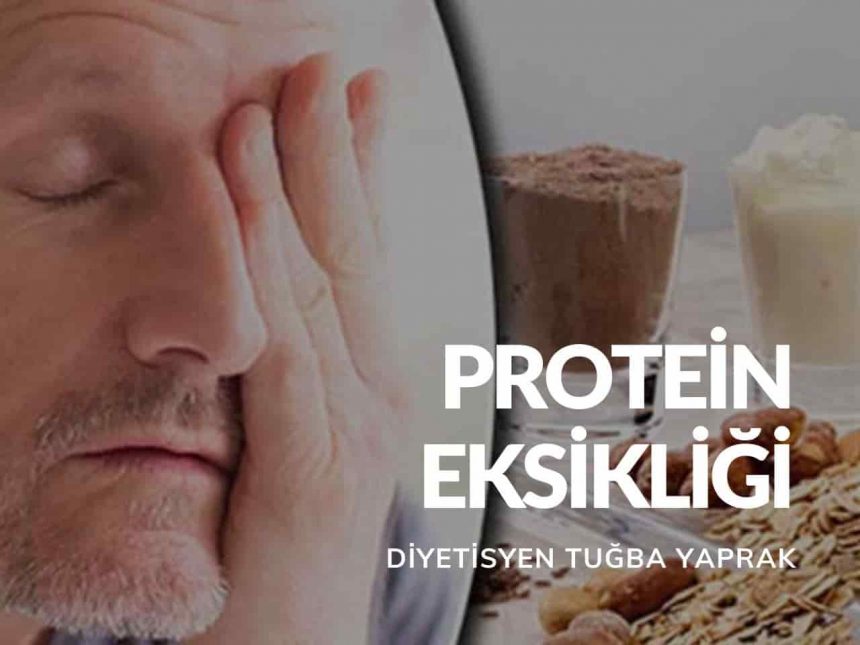 Protein Eksikliği