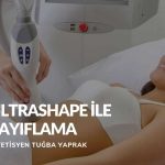 Ultrashape Ile Zayıflama